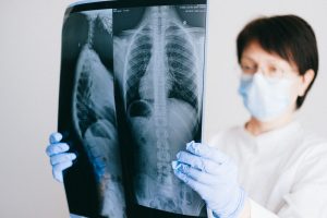 Jak zaopatrzyć się w urządzenia rentgenowskie do pracowni?